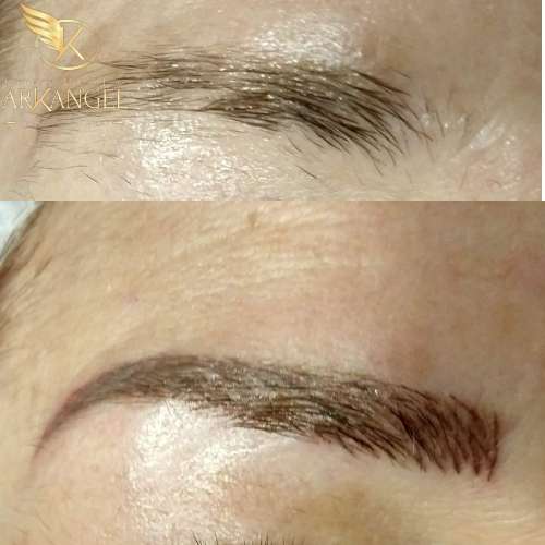 cejas antes des