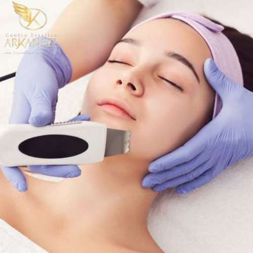 peeling facial en medellin PEELING